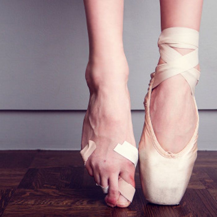 Eastern Foot Care Ingrown Toenails in Dancers
