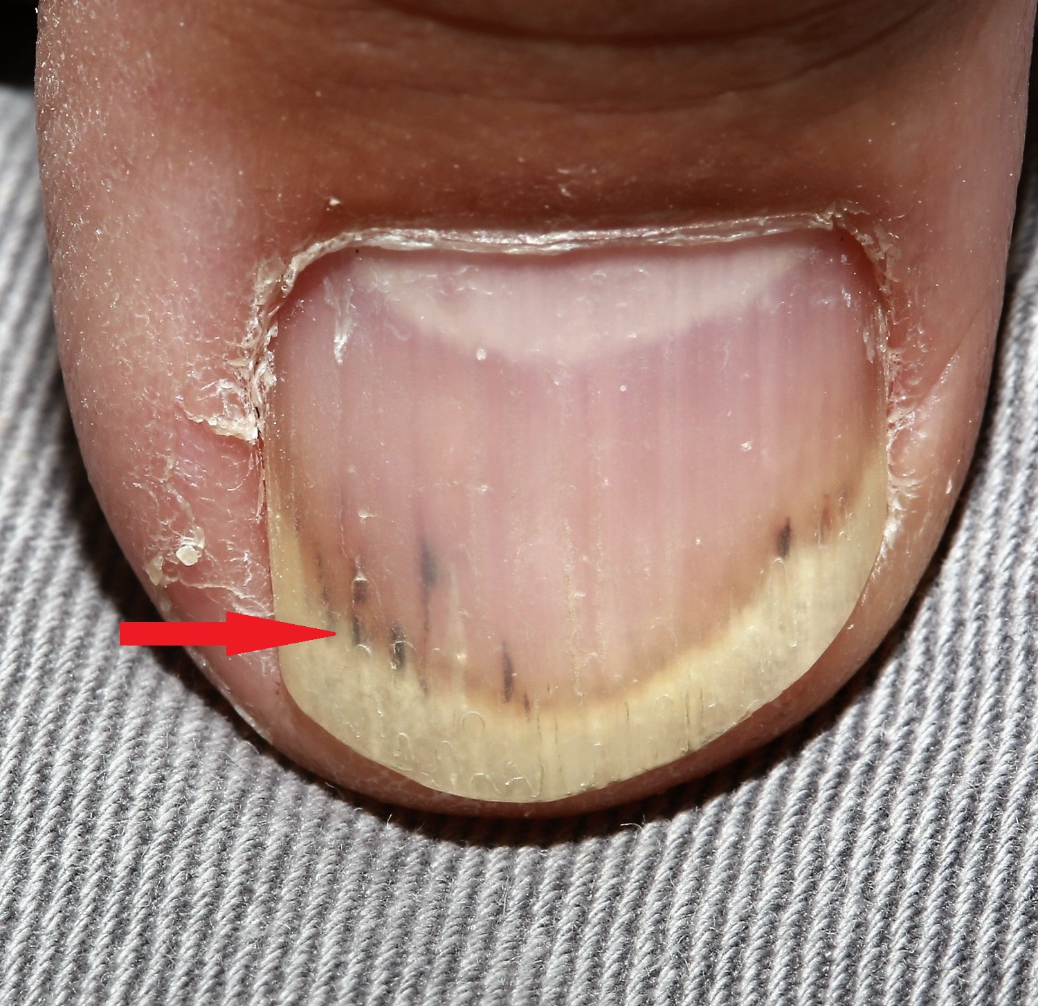 Eastern Foot Care Nailing the Diagnosis Eastern Foot Care